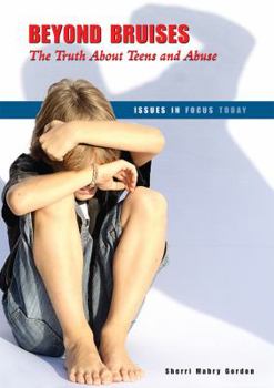 Beyond Bruises: The Truth About Teens and Abuse - Book  of the Issues in Focus Today
