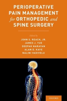 Paperback Perioperative Pain Management for Orthopedic and Spine Surgery Book