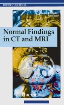 Paperback Normal Findings in Ct and Mri (Thieme Flexibook) Book