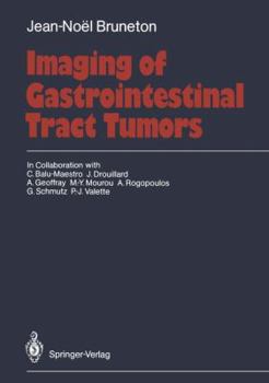 Paperback Imaging of Gastrointestinal Tract Tumors Book