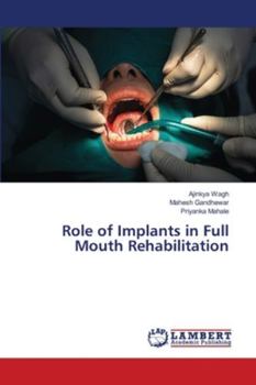 Paperback Role of Implants in Full Mouth Rehabilitation Book