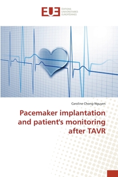 Paperback Pacemaker implantation and patient's monitoring after TAVR Book