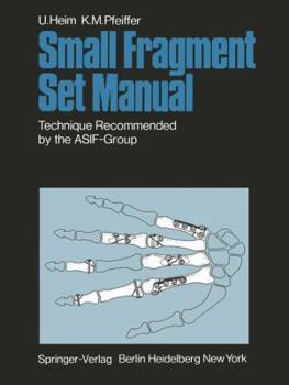 Paperback Small Fragment Set Manual: Technique Recommanded by the Asif-Group Book