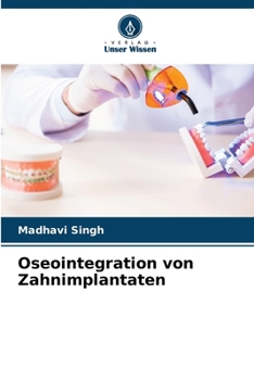 Paperback Oseointegration von Zahnimplantaten [German] Book
