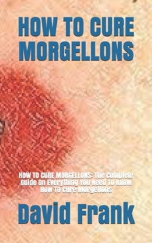 Paperback How to Cure Morgellons: HOW TO CURE MORGELLONS: The Complete Guide On Everything You Need To Know How To Cure Morgellons Book