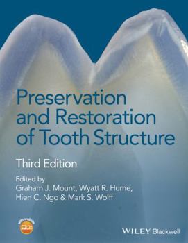 Hardcover Preservation and Restoration of Tooth Structure Book