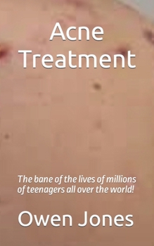 Paperback Acne Treatment Book