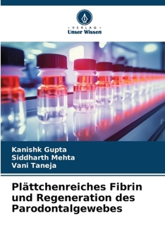 Paperback Plättchenreiches Fibrin und Regeneration des Parodontalgewebes (German Edition) [German] Book