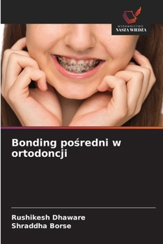 Bonding posredni w ortodoncji (Polish Edition)