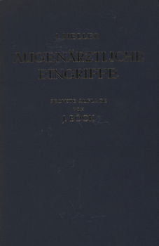 Paperback Augenärztliche Eingriffe: Eine Kurzgefasste Operationslehre [German] Book