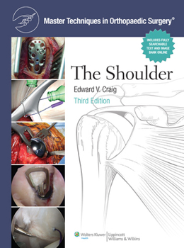 Hardcover Master Techniques in Orthopaedic Surgery: Shoulder Book