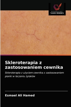 Paperback Skleroterapia z zastosowaniem cewnika [Polish] Book