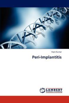 Paperback Peri-Implantitis Book