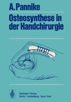 Paperback Osteosynthese in Der Handchirurgie [German] Book