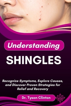 Paperback Understanding Shingles: Recognize Symptoms, Explore Causes, and Discover Proven Strategies for Relief and Recovery Book