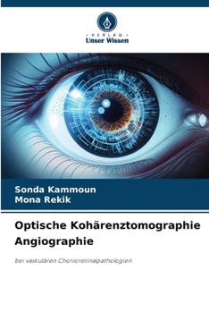 Paperback Optische Kohärenztomographie Angiographie [German] Book