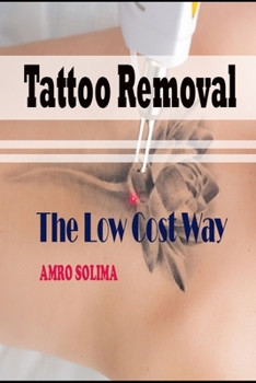 Paperback Tattoo Removal: The Low Cost Way Book