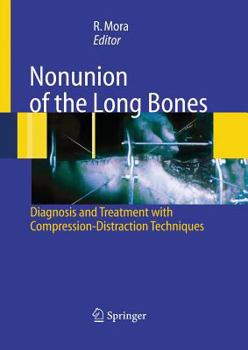 Paperback Nonunion of the Long Bones: Diagnosis and Treatment with Compression-Distraction Techniques Book