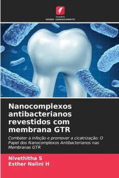 Nanocomplexos antibacterianos revestidos com membrana GTR (Portuguese Edition)