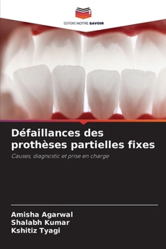 Défaillances des prothèses partielles fixes (French Edition)