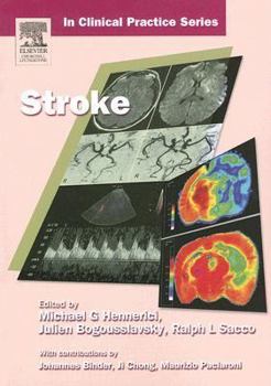 Paperback Churchill's in Clinical Practice Series: Stroke Book