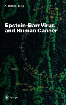 Hardcover Epstein-Barr Virus and Human Cancer Book