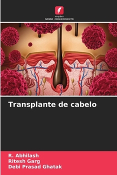 Paperback Transplante de cabelo [Portuguese] Book