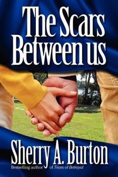 Paperback The Scars Between Us Book