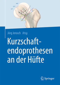 Hardcover Kurzschaftendoprothesen an Der Hüfte [German] Book