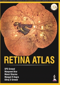 Hardcover Retina Atlas Book