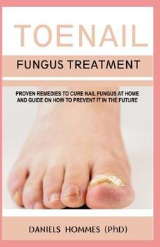 Paperback Toenail Fungus Treatment: Natural Toenail Fungus Treatment and Cures Book