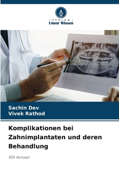 Paperback Komplikationen bei Zahnimplantaten und deren Behandlung (German Edition) [German] Book