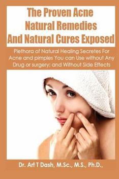 Paperback The Proven Acne Natural Remedies And Natural Cures Exposed: Plethora Of Natural Healing Secretes For Acne and Pimples You Can Use Without Any Drug or Book