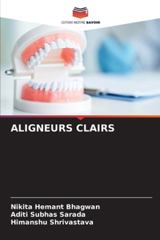 Aligneurs Clairs (French Edition)