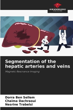 Paperback Segmentation of the hepatic arteries and veins Book