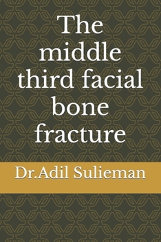 Paperback The middle third facial bone fracture Book
