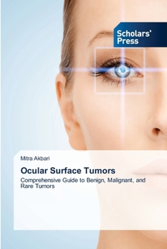 Paperback Ocular Surface Tumors Book