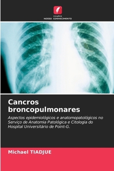Paperback Cancros broncopulmonares [Portuguese] Book