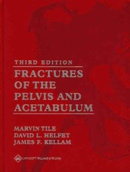 Hardcover Fractures of the Pelvis and Acetabulum Book