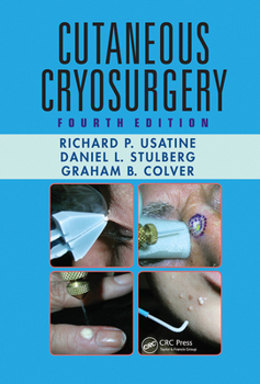 Paperback Cutaneous Cryosurgery Book