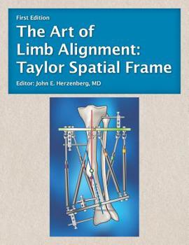 Paperback The Art of Limb Alignment: Taylor Spatial Frame Book