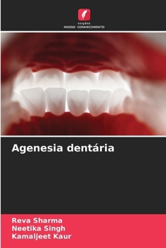 Agenesia dentária (Portuguese Edition)