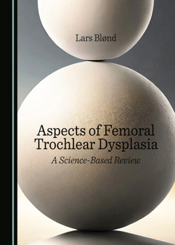 Hardcover Aspects of Femoral Trochlear Dysplasia: A Science-Based Review Book