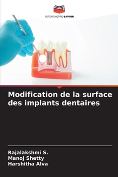 Modification de la surface des implants dentaires (French Edition)