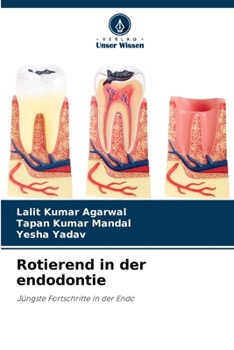 Paperback Rotierend in der endodontie [German] Book