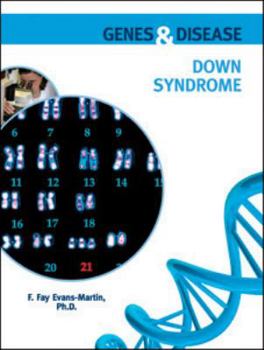Hardcover Down Syndrome Book