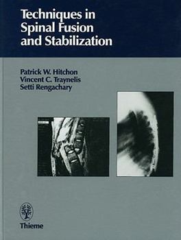 Hardcover Techniques in Spinal Fusion and Stabilization: Book