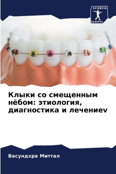 Paperback Клыки со смещенным нёбом [Russian] Book