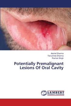 Paperback Potentially Premalignant Lesions Of Oral Cavity Book