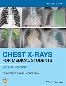 Paperback Chest X-Rays for Medical Students: Cxrs Made Easy Book